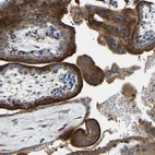 Immunohistochemical staining of human placenta shows strong cytoplasmic granular positivity in trophoblastic cells.