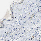 Anti-DPP7 Antibody