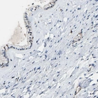 Immunohistochemical staining of human cervix, uterine shows no positivity in squamous epithelial cells as expected.