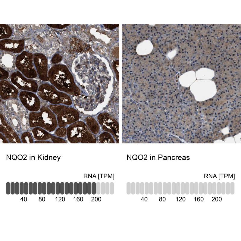 Anti-NQO2 Antibody