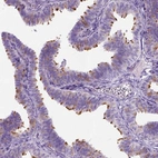 Immunohistochemical staining of human fallopian tube shows high expression.
