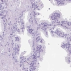 Immunohistochemical staining of human prostate shows low expression as expected.