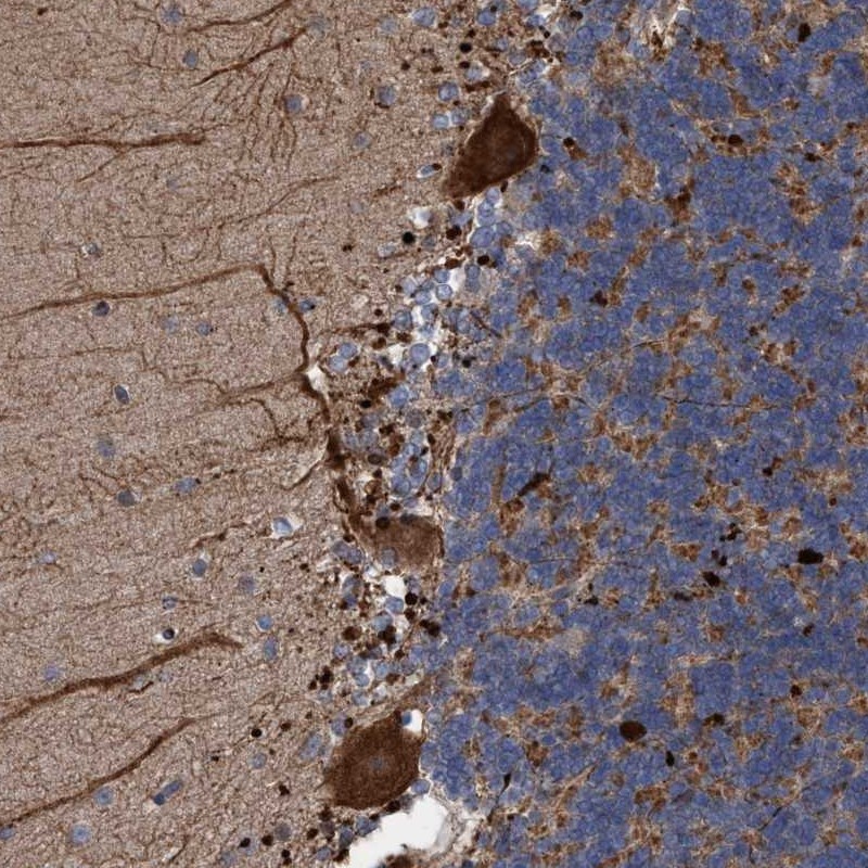 Anti-BBS9 Antibody
