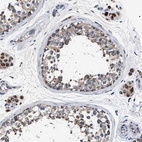Immunohistochemical staining of human testis shows strong granular cytoplasmic positivity in cells in seminiferous ducts.