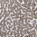 Immunohistochemical staining of human liver shows strong granular cytoplasmic positivity in hepatocytes.
