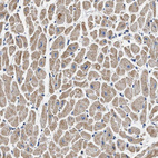 Immunohistochemical staining of human heart muscle shows moderate granular cytoplasmic positivity in cardiomyocytes.