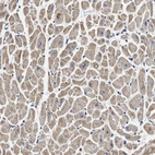 Immunohistochemical staining of human heart muscle shows moderate granular cytoplasmic positivity in cardiomyocytes.