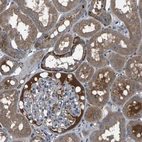 Immunohistochemical staining of human kidney shows moderate cytoplasmic positivity in cells in tubules.