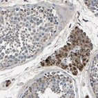 Immunohistochemical staining of human testis shows strong cytoplasmic positivity in Leydig cells.