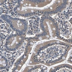 Immunohistochemical staining of human duodenum shows moderate cytoplasmic positivity in glandular cells.