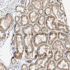 Immunohistochemical staining of human kidney shows moderate granular cytoplasmic positivity in cells in tubules.