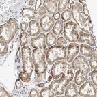 Immunohistochemical staining of human kidney shows moderate granular cytoplasmic positivity in cells in tubules.
