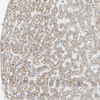 Immunohistochemical staining of human liver shows moderate granular cytoplasmic positivity in hepatocytes.