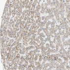 Immunohistochemical staining of human liver shows moderate granular cytoplasmic positivity in hepatocytes.
