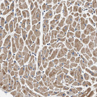 Immunohistochemical staining of human heart muscle shows moderate granular cytoplasmic positivity in cardiomyocytes.