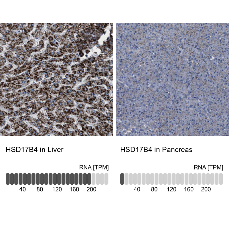 Anti-HSD17B4 Antibody