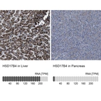 Immunohistochemistry analysis in human liver and pancreas tissues using Anti-HSD17B4 antibody. Corresponding HSD17B4 RNA-seq data are presented for the same tissues.