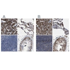 Immunohistochemical staining of human liver, lung, lymph node and testis using Anti-HSD17B4 antibody HPA021302 (A) shows similar protein distribution across tissues to independent antibody HPA021311 (B).