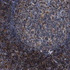 Immunohistochemical staining of human lymph node shows high expression.
