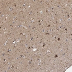 Immunohistochemical staining of human cerebral cortex shows moderate cytoplasmic positivity in neurons.