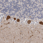 Anti-DLG2 Antibody