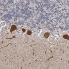 Immunohistochemical staining of human cerebellum shows strong cytoplasmic positivity in purkinje cells.