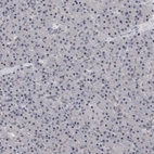 Immunohistochemical staining of human pancreas shows no positivity as expected.
