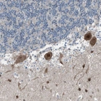Anti-ZNF276 Antibody