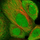 Immunofluorescent staining of human cell line A-431 shows positivity in nucleoli, cytoplasm, cell junctions & nucleus but excluded from the nucleoli.