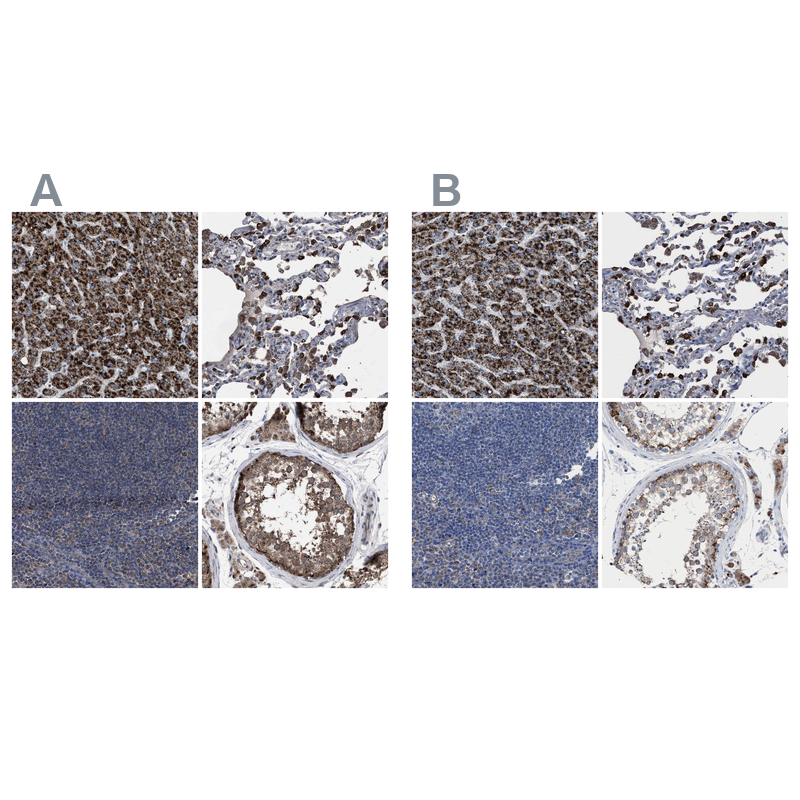 Anti-HSD17B4 Antibody