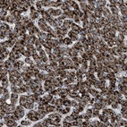 Immunohistochemical staining of human liver shows strong cytoplasmic granular positivity in hepatocytes.