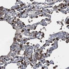 Immunohistochemical staining of human lung shows strong cytoplasmic positivity in pneumocytes.