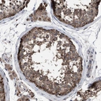 Immunohistochemical staining of human testis shows strong cytoplasmic positivity in cells in seminiferous ducts.