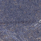 Immunohistochemical staining of human lymph node shows no positivity in non-germinal center cells as expected.