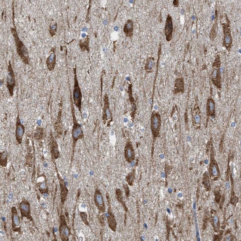 Anti-WDR60 Antibody