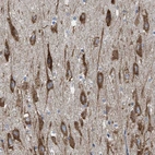 Anti-WDR60 Antibody