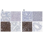 Immunohistochemical staining of human kidney, liver, pancreas and testis using Anti-CPA2 antibody HPA021317 (A) shows similar protein distribution across tissues to independent antibody HPA020342 (B).