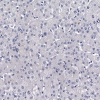 Immunohistochemical staining of human liver shows no positivity in hepatocytes as expected.