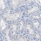 Anti-CPA2 Antibody