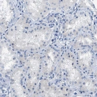 Immunohistochemical staining of human kidney shows no positivity in cells in tubules as expected.