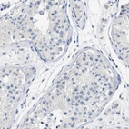 Immunohistochemical staining of human testis shows no positivity in cells in seminiferous ducts as expected.