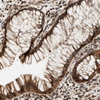 Immunohistochemical staining of human rectum shows strong cytoplasmic positivity in glandular cells.