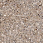 Immunohistochemical staining of human liver shows moderate cytoplasmic positivity in hepatocytes.