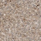 Immunohistochemical staining of human liver shows moderate cytoplasmic positivity in hepatocytes.