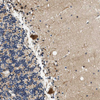 Immunohistochemical staining of human cerebellum shows strong cytoplasmic positivity in Purkinje cells.