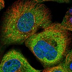 Immunofluorescent staining of human cell line A-431 shows localization to cytosol & vesicles.
