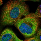 Immunofluorescent staining of human cell line A-431 shows localization to cytosol & vesicles.