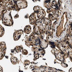 Immunohistochemical staining of human placenta shows moderate cytoplasmic positivity in trophoblastic cells.
