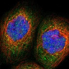 Immunofluorescent staining of human cell line A-431 shows localization to cytosol & vesicles.