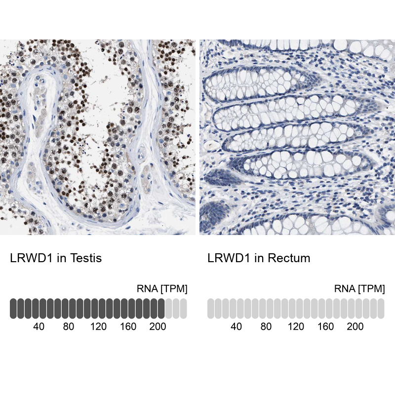 Anti-LRWD1 Antibody